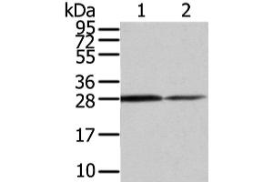 Western Blot analysis of Mouse stomach and Human fetal muscle tissue using RHOU Polyclonal Antibody at dilution of 1/200 (RHOU anticorps)