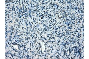 Immunohistochemical staining of paraffin-embedded colon tissue using anti-TMEM100mouse monoclonal antibody. (TMEM100 anticorps)