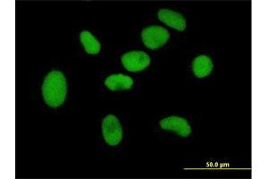 Immunofluorescence of purified MaxPab antibody to ZNF189 on HeLa cell. (ZNF189 anticorps  (AA 1-584))