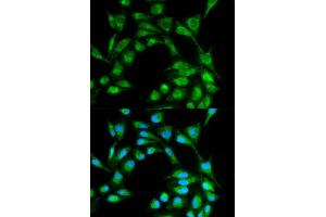 Immunofluorescence analysis of MCF7 cell using ICOS antibody. (ICOS anticorps  (AA 21-140))