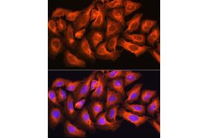 Immunofluorescence analysis of U2OS cells using CK antibody (ABIN6127628, ABIN6138647, ABIN6138648 and ABIN6224627) at dilution of 1:100. (CKAP5 anticorps  (AA 1763-2032))