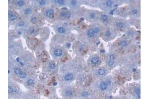 Detection of PTCH1 in Mouse Liver Tissue using Polyclonal Antibody to Patched Homolog 1 (PTCH1)