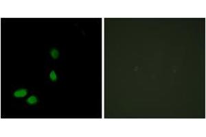 Immunofluorescence analysis of HeLa cells, using HMG17 Antibody. (HMGN2 anticorps  (AA 1-50))