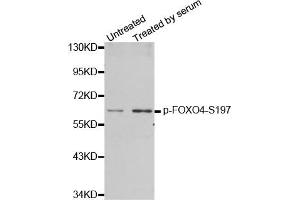 Western Blotting (WB) image for anti-Forkhead Box O4 (FOXO4) (pSer197) antibody (ABIN1870198)