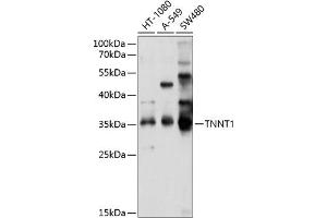 Western blot analysis of extracts of various cell lines, using TNNT1 antibody (ABIN6127683, ABIN6149363, ABIN6149364 and ABIN6214579) at 1:1000 dilution.