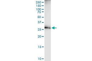 Immunoprecipitation of ECH1 transfected lysate using anti-ECH1 MaxPab rabbit polyclonal antibody and Protein A Magnetic Bead , and immunoblotted with ECH1 purified MaxPab mouse polyclonal antibody (B01P) .