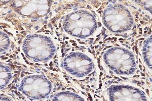 Immunohistochemistry analysis of paraffin-embedded human colon using,IL-3RB (ABIN7073557) at dilution of 1: 4000 (CD131 anticorps)