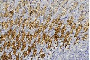 ABIN6273593 at 1/100 staining Human gastric tissue by IHC-P. (TRIM31 anticorps  (Internal Region))