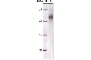 Western Blotting (WB) image for anti-Keratin 1 (KRT1) (truncated) antibody (ABIN2464043)
