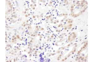 Immunohistochemistry (IHC) image for anti-Exosome Component 10 (EXOSC10) (AA 200-250) antibody (ABIN7454996) (EXOSC10 anticorps  (AA 200-250))