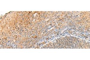 Immunohistochemistry of paraffin-embedded Human tonsil tissue using GPR161 Polyclonal Antibody at dilution of 1:40(x200)