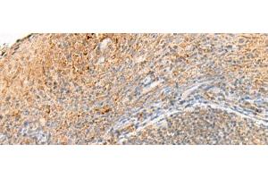 Immunohistochemistry of paraffin-embedded Human tonsil tissue using GPR161 Polyclonal Antibody at dilution of 1:40(x200) (GPR161 anticorps)