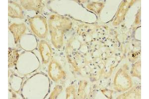 Immunohistochemistry of paraffin-embedded human kidney tissue using ABIN7169587 at dilution of 1:100 (SFXN2 anticorps  (AA 1-99))