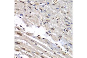 Immunohistochemistry of paraffin-embedded mouse heart using HNRNPM antibody (ABIN5975447) at dilution of 1/100 (40x lens). (HNRNPM anticorps)
