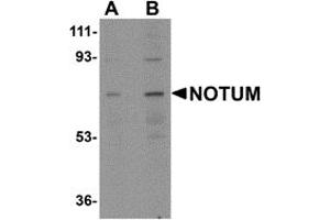 Western Blotting (WB) image for anti-Notum Pectinacetylesterase Homolog (NOTUM) (N-Term) antibody (ABIN1031488) (NOTUM anticorps  (N-Term))