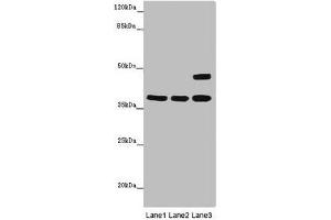 Western blot analysis (1) Thp1 whole cell lysates, (2) K562 whole cell lysates, and (3) Mouse brain tissue, using MR1 antibody (6 μg/ml) and Goat anti-Rabbit IgG polyclonal secondary antibody (1/10000 dilution).