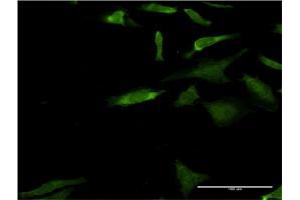 Immunofluorescence of monoclonal antibody to MAPK3 on HeLa cell. (ERK1 anticorps  (AA 279-379))