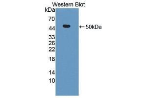 Western Blotting (WB) image for anti-Matrix Metallopeptidase 19 (MMP19) (AA 98-508) antibody (ABIN1869238) (MMP19 anticorps  (AA 98-508))