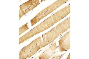 (ABIN655059 and ABIN2844688) staining C in Human skeletal muscle tissue sections by Immunohistochemistry (IHC-P - paraformaldehyde-fixed, paraffin-embedded sections).