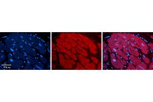 Rabbit Anti-NR3C1 Antibody Catalog Number: ARP31090_P050 Formalin Fixed Paraffin Embedded Tissue: Human heart Tissue Observed Staining: Cytoplasmic, nucleus Primary Antibody Concentration: 1:100 Other Working Concentrations: 1:600 Secondary Antibody: Donkey anti-Rabbit-Cy3 Secondary Antibody Concentration: 1:200 Magnification: 20X Exposure Time: 0.