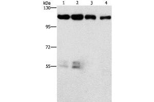 Western Blot analysis of Hela and hepG2 cell, lovo cell and Human colon cancer tissue using CDK11B Polyclonal Antibody at dilution of 1:750 (CDK11 anticorps)