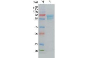Cynomolgus CD7 Protein, hFc Tag on SDS-PAGE under reducing condition.