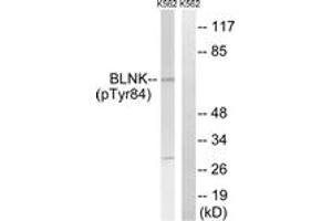 Western blot analysis of extracts from K562 cells treated with starved 24h, using BLNK (Phospho-Tyr84) Antibody. (B-Cell Linker anticorps  (pTyr84))