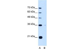 WB Suggested Anti-TOR1B Antibody Titration:  5. (TOR1B anticorps  (C-Term))