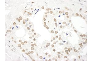 anti-DEAD (Asp-Glu-Ala-Asp) Box Polypeptide 27 (DDX27) (AA 700-750) antibody