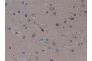 anti-Toll-Like Receptor 9 (TLR9) (AA 28-362) antibody