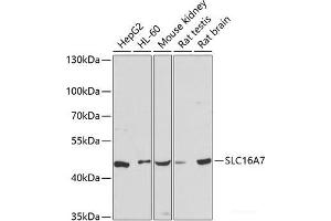 Western blot analysis of extracts of various cell lines using SLC16A7 Polyclonal Antibody at dilution of 1:3000. (SLC16A7 anticorps)