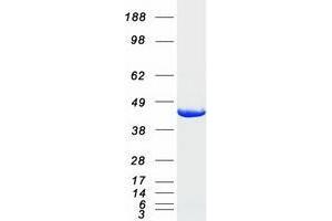 Validation with Western Blot