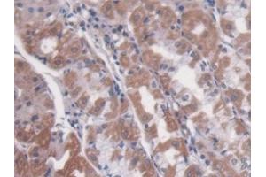 Detection of NAGLU in Human Stomach Tissue using Polyclonal Antibody to N-Acetyl Alpha-D-Glucosaminidase (NAGLU)