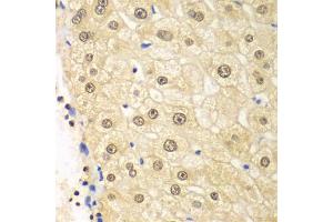 Immunohistochemistry of paraffin-embedded human liver injury using PSMD2 antibody (ABIN1874389) at dilution of 1:100 (40x lens). (PSMD2 anticorps)