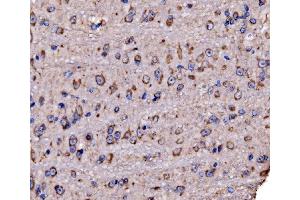 IHC analysis of RPL17 using anti-RPL17 antibody (ABIN7601639).