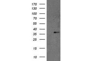Western Blotting (WB) image for anti-Retinol Dehydrogenase 14 (All-Trans/9-Cis/11-Cis) (RDH14) antibody (ABIN1500655) (RDH14 anticorps)