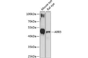 Western blot analysis of extracts of various cell lines, using  antibody (ABIN6131237, ABIN6137133, ABIN6137134 and ABIN6216833) at 1:3000 dilution.