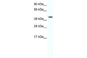 WB Suggested Anti-FOXF1A Antibody Titration:  2.
