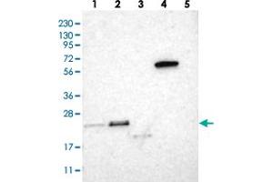 Western blot analysis of Lane 1: RT-4, Lane 2: U-251 MG, Lane 3: Human Plasma, Lane 4: Liver, Lane 5: Tonsil with TEX261 polyclonal antibody  at 1:250-1:500 dilution. (TEX261 anticorps)