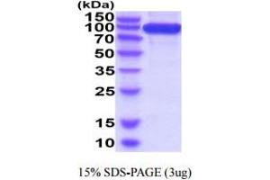 SDS-PAGE (SDS) image for Basal Cell Adhesion Molecule (Lutheran Blood Group) (BCAM) (AA 32-547) protein (hIgG-His-tag) (ABIN5854904)