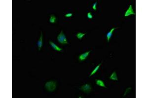Immunofluorescence staining of SH-SY5Y cells with ABIN7157420 at 1:133, counter-stained with DAPI.
