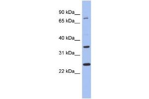 WB Suggested Anti-ZNF133 Antibody Titration:  0. (ZNF133 anticorps  (N-Term))