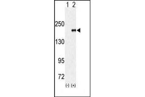 Western blot analysis of EUHMTASE (arrow) using rabbit polyclonal EHMT1 (EUHMTASE1) Antibody (Center) (ABIN387926 and ABIN2844398). (EHMT1 anticorps  (AA 979-1010))