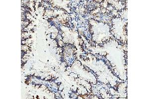 IHC analysis of MUT using anti-MUT antibody (ABIN4886676). (MUT anticorps  (N-Term))
