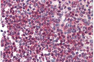 anti-HtrA Serine Peptidase 2 (HTRA2) (C-Term) antibody