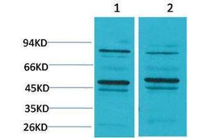 Western Blotting (WB) image for anti-Bestrophin 2 (BEST2) antibody (ABIN3181534) (Bestrophin 2 anticorps)