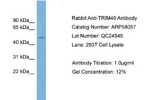 WB Suggested Anti-TRIM49  Antibody Titration: 0. (TRIM49 anticorps  (Middle Region))