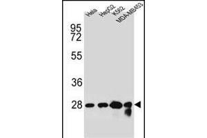 CHPT1 Antibody (N-term) (ABIN654145 and ABIN2844012) western blot analysis in Hela,HepG2,K562,MDA-M cell line lysates (35 μg/lane). (CHPT1 anticorps  (N-Term))