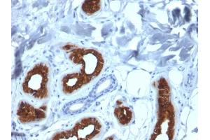 Formalin-fixed, paraffin-embedded human Skin stained with Cytokeratin 3 Mouse Monoclonal Antibody (KRT3/2130).
