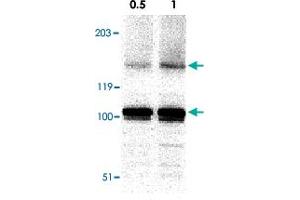 Western blot analysis of IKBKAP in A-20 cell lysate with IKBKAP polyclonal antibody  at in 0. (IKAP/p150 anticorps  (C-Term))